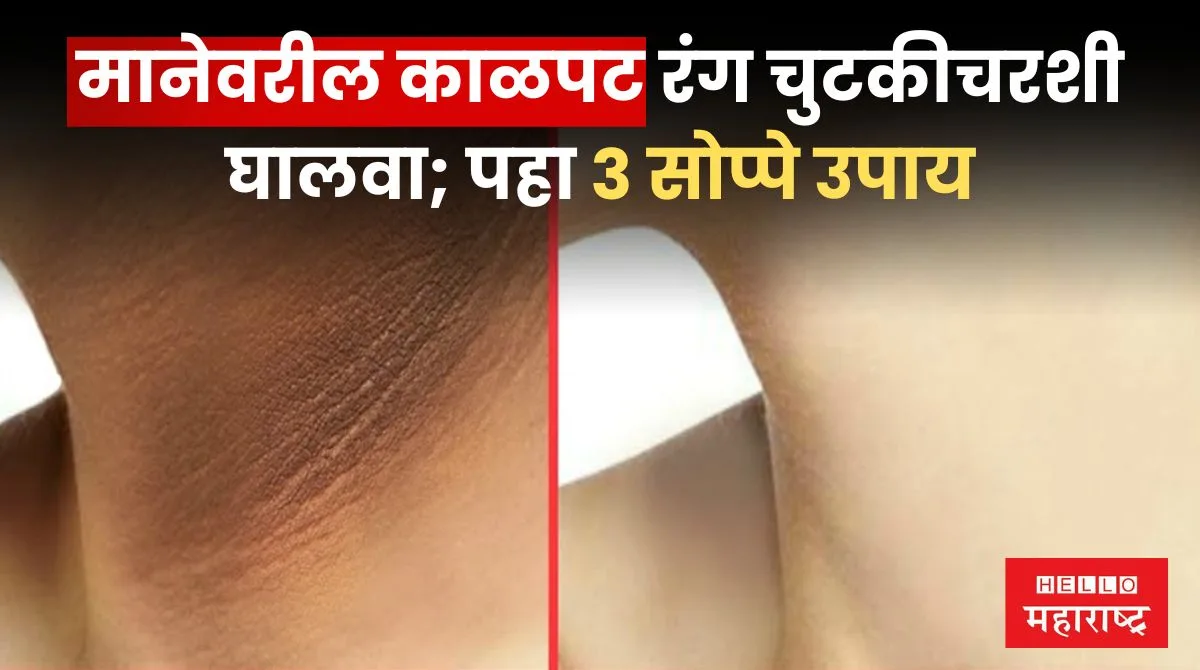How To Remove Tanning From Neck