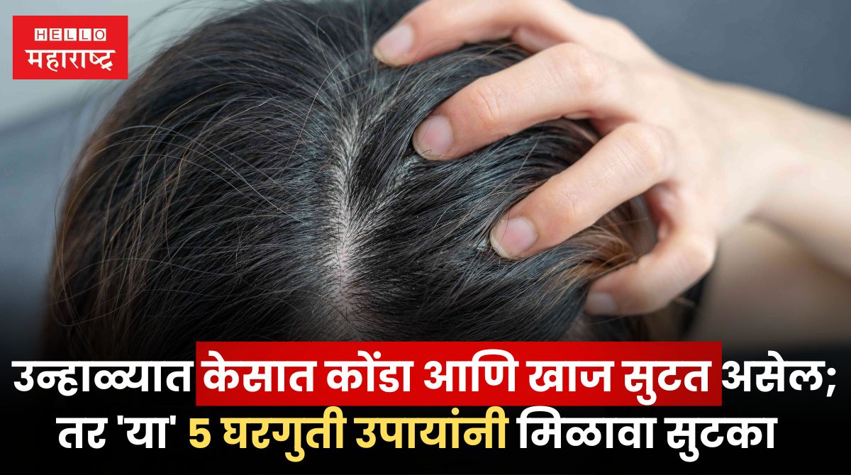 Home Remedies For Itchy Scalp