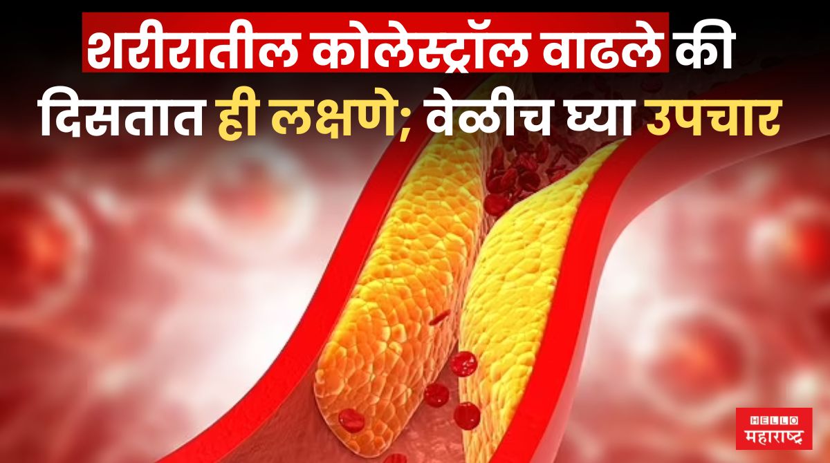 Hidden Sign Of Cholesterol