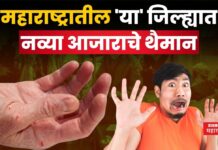 महाराष्ट्रातील ‘या’ जिल्ह्यात नव्या आजाराचे थैमान; नागरिकांमध्ये घबराट buldhana crack in hand disease